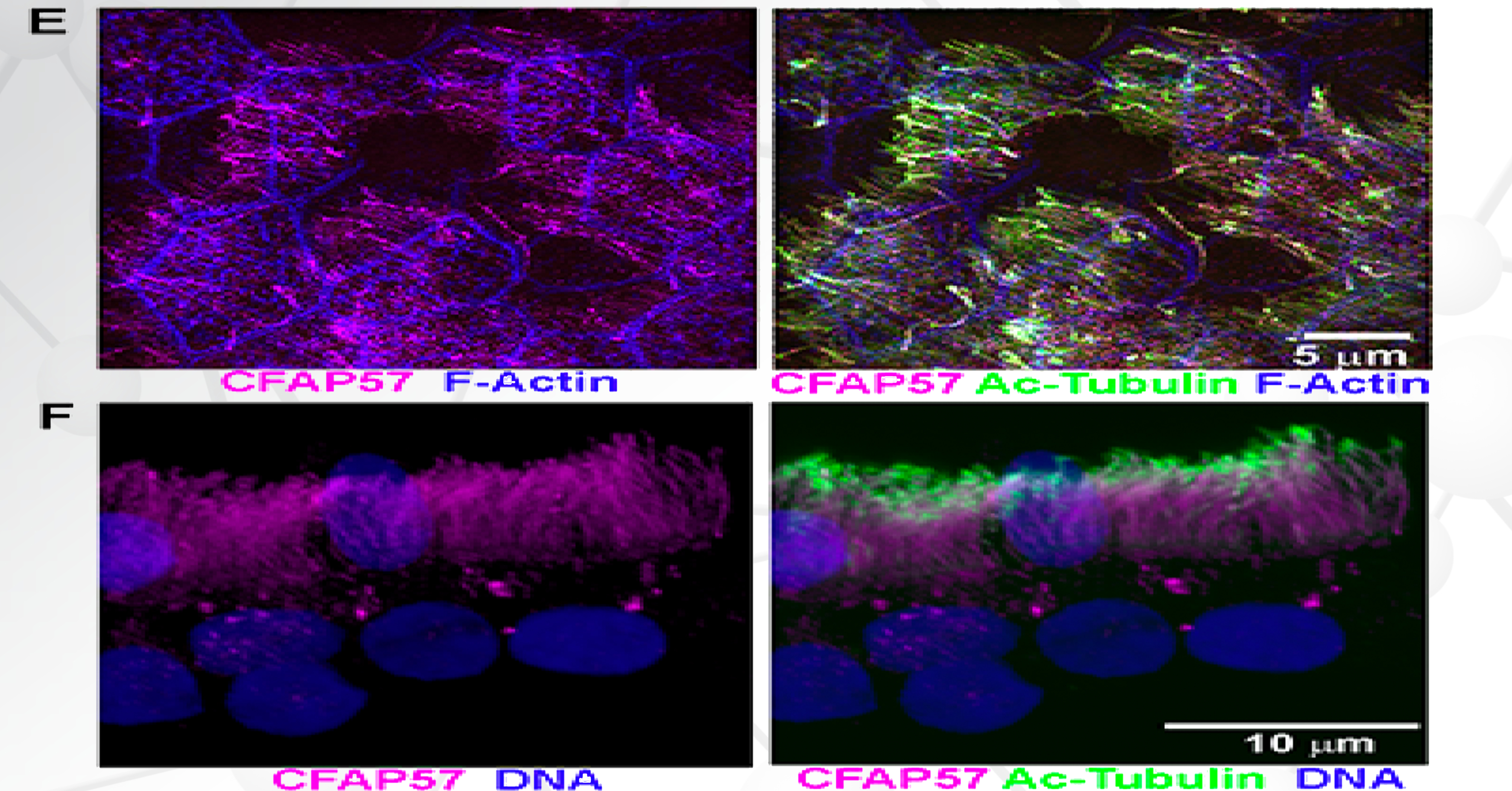 Expression and localization of CFAP57 in human airway epithelial cells. © 2020 Bustamante-Marin et al.